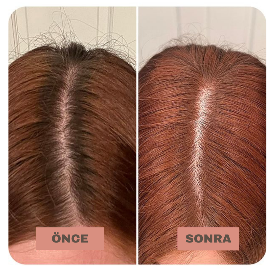 Hairium Saç Dolgunlaştırıcı