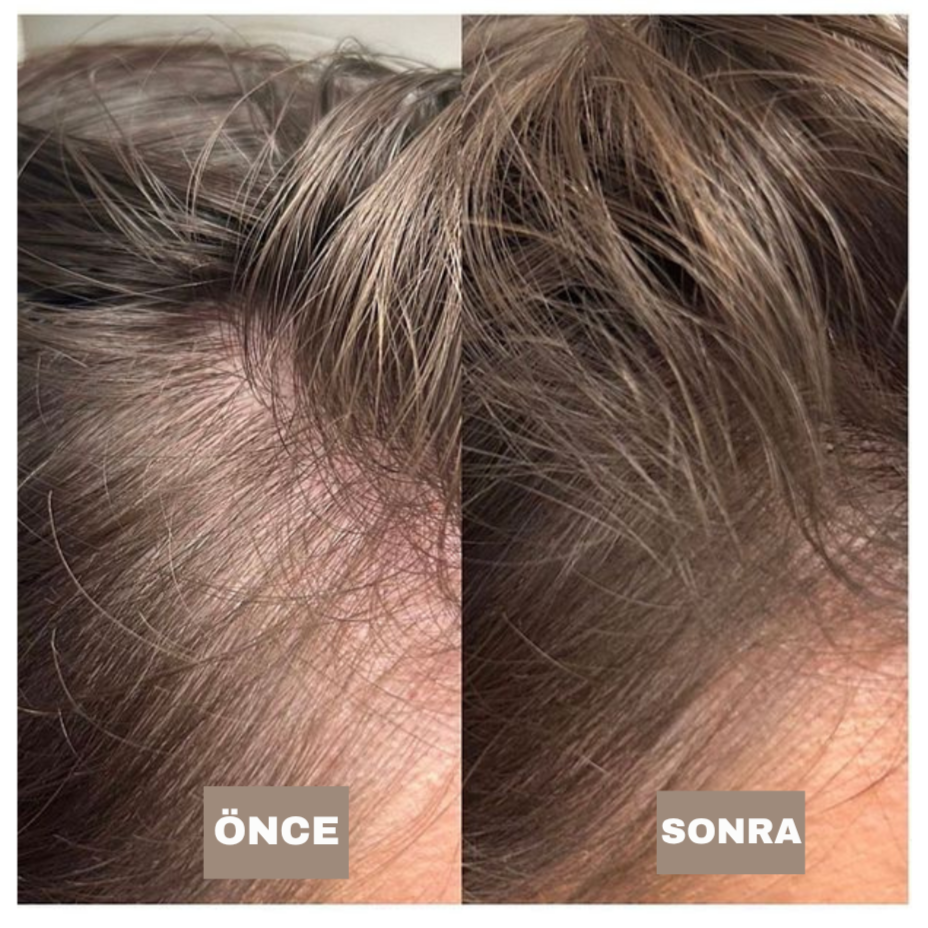 Hairium Saç Dolgunlaştırıcı