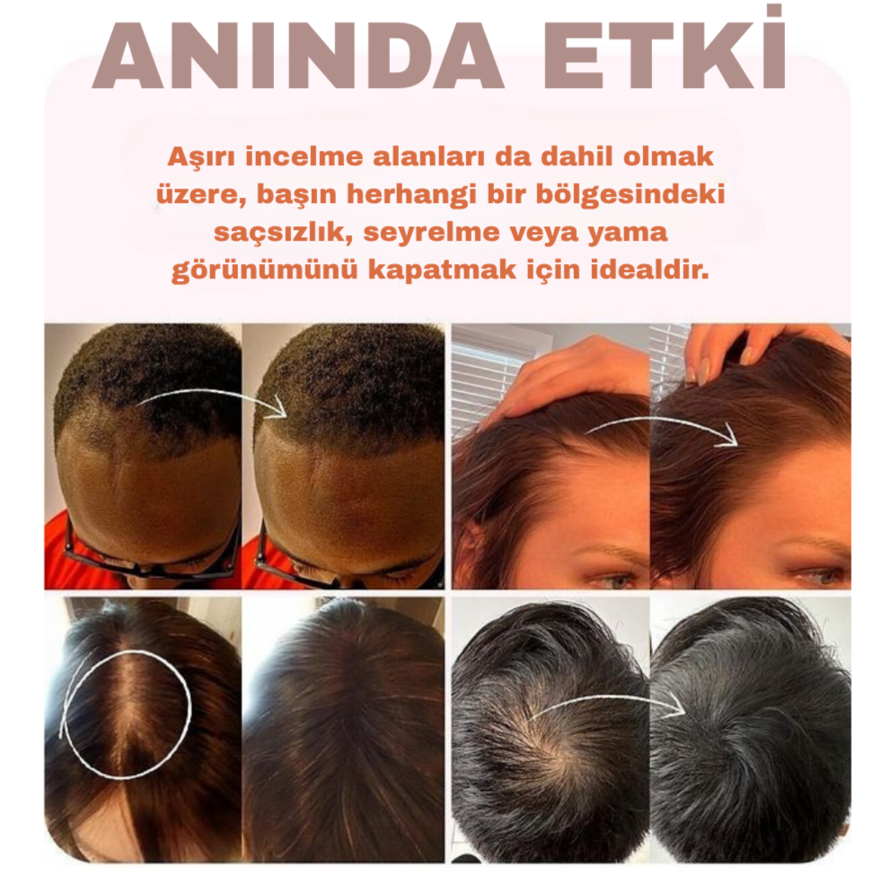 Hairium Saç Dolgunlaştırıcı