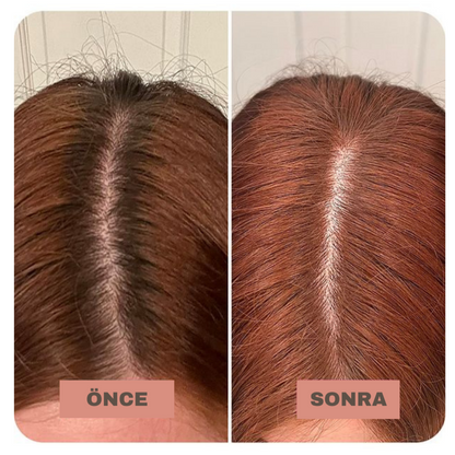Hairium Saç Dolgunlaştırıcı